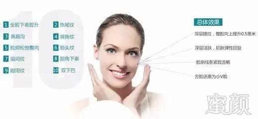 https://img.miyanlife.com/mnt/timg/180626/111A215b-7.jpg