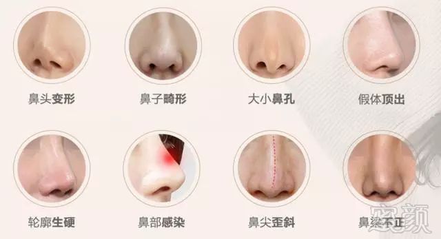 https://img.miyanlife.com/mnt/timg/180626/111PMZ2-3.jpg
