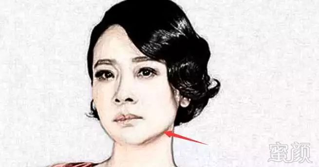 案例图片