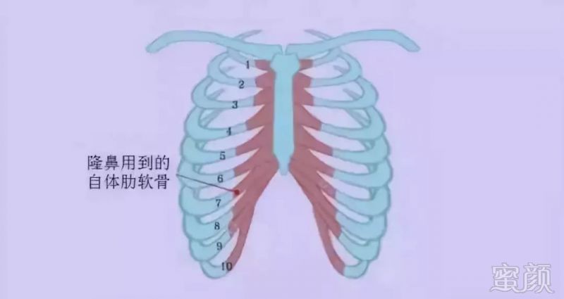 案例图片