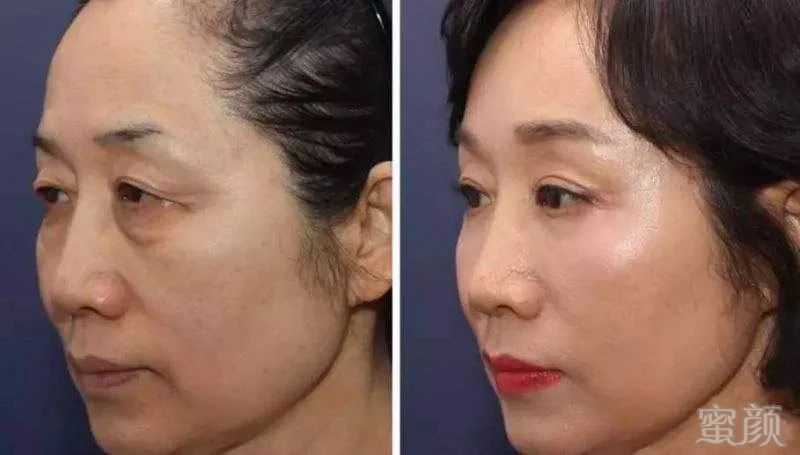 https://img.miyanlife.com/mnt/timg/180626/1142263F3-3.jpg