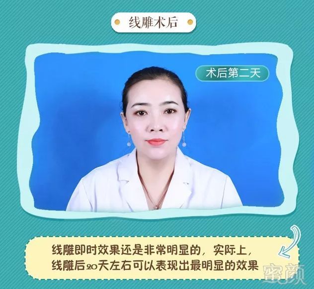 https://img.miyanlife.com/mnt/timg/180626/1142291256-9.jpg