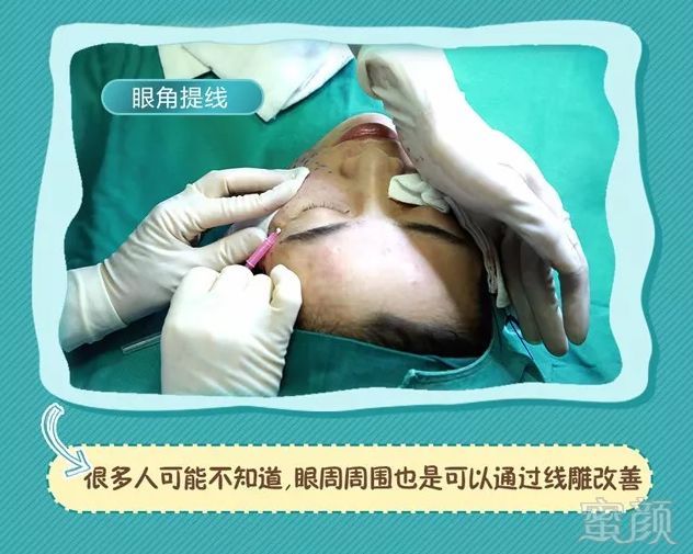 https://img.miyanlife.com/mnt/timg/180626/114229E51-8.jpg