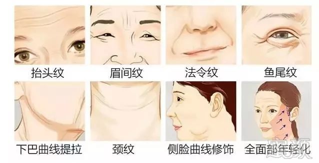 https://img.miyanlife.com/mnt/timg/180626/11422C605-1.jpg
