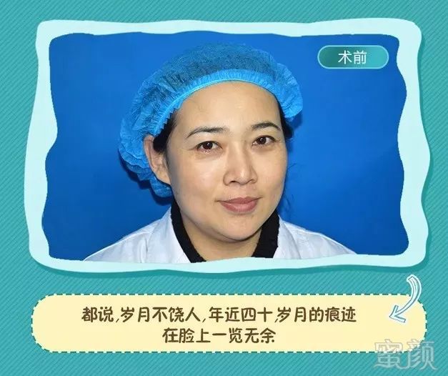 https://img.miyanlife.com/mnt/timg/180626/11422GB5-5.jpg