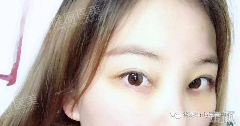 https://img.miyanlife.com/mnt/timg/180626/114UJ096-3.jpg