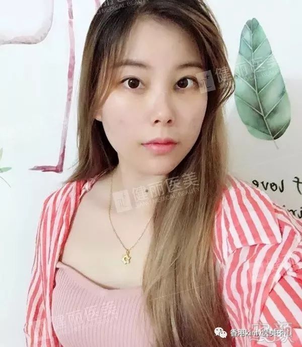 https://img.miyanlife.com/mnt/timg/180626/114ULA8-4.jpg