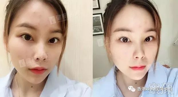 https://img.miyanlife.com/mnt/timg/180626/114US0P-5.jpg