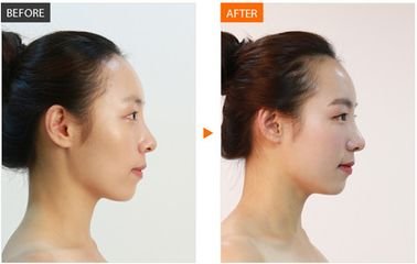 https://img.miyanlife.com/mnt/timg/180626/115H16003-13.jpg