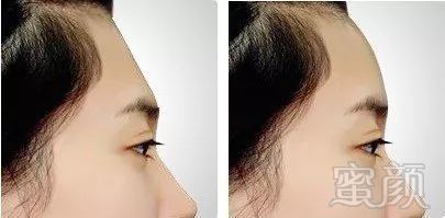 https://img.miyanlife.com/mnt/timg/180626/115H1J11-12.jpg