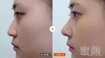 https://img.miyanlife.com/mnt/timg/180626/115H22436-15.jpg