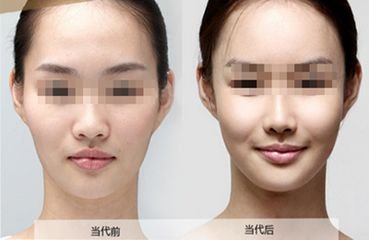 https://img.miyanlife.com/mnt/timg/180626/115H22560-14.jpg