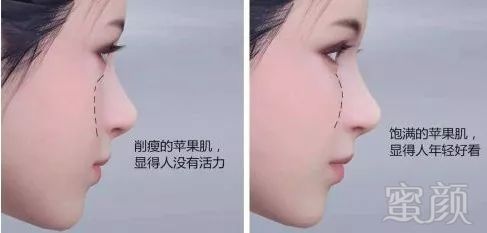https://img.miyanlife.com/mnt/timg/180626/1201043127-1.jpg