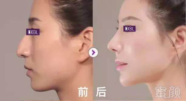 https://img.miyanlife.com/mnt/timg/180626/12010BH4-5.jpg
