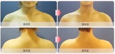 https://img.miyanlife.com/mnt/timg/180626/120R93549-3.jpg
