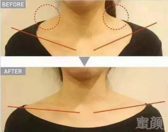 https://img.miyanlife.com/mnt/timg/180626/120R941M-4.jpg