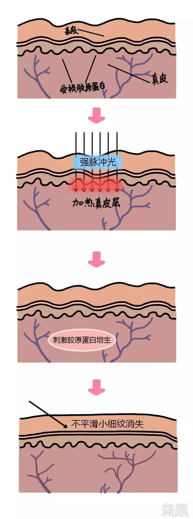 案例图片