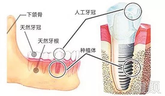 https://img.miyanlife.com/mnt/timg/180627/11053R601-0.jpg