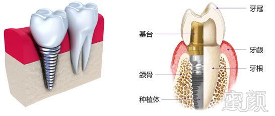 https://img.miyanlife.com/mnt/timg/180627/11053WQ9-2.jpg