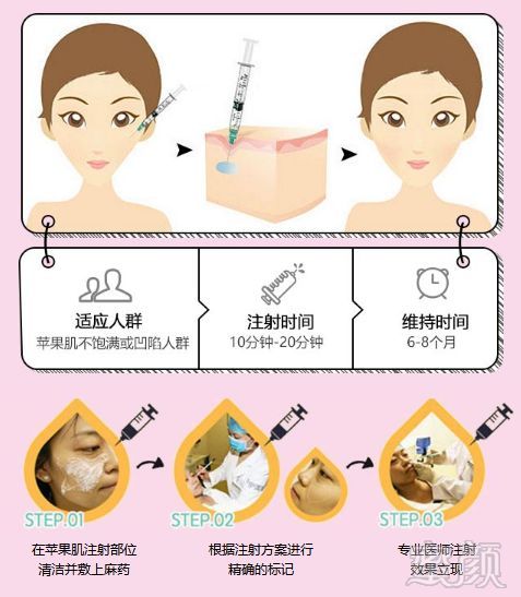 https://img.miyanlife.com/mnt/timg/180627/1106406316-8.jpg