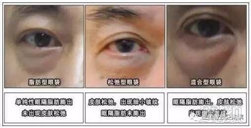 https://img.miyanlife.com/mnt/timg/180627/1110011118-2.jpg