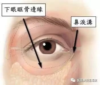https://img.miyanlife.com/mnt/timg/180627/1110015054-0.jpg