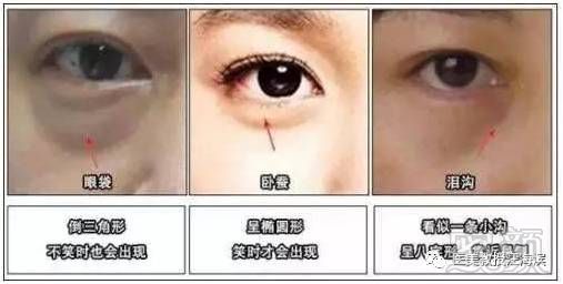 https://img.miyanlife.com/mnt/timg/180627/1110021346-3.jpg