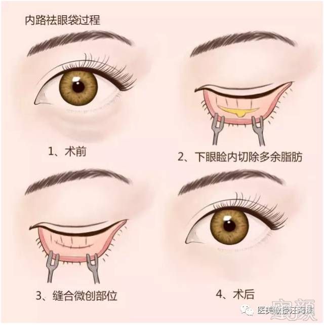 https://img.miyanlife.com/mnt/timg/180627/1110022044-4.jpg