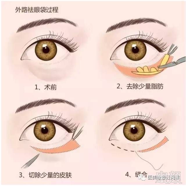 https://img.miyanlife.com/mnt/timg/180627/111002B58-5.jpg