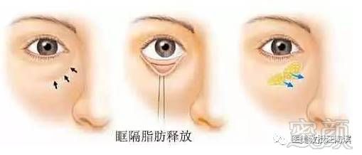 https://img.miyanlife.com/mnt/timg/180627/111002EC-6.jpg