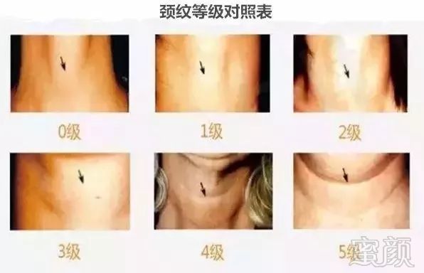 https://img.miyanlife.com/mnt/timg/180627/114543E35-2.jpg