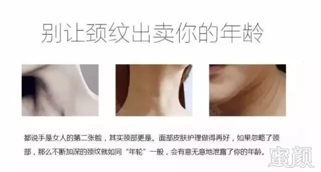 https://img.miyanlife.com/mnt/timg/180627/1145452422-4.jpg