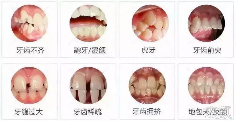 https://img.miyanlife.com/mnt/timg/180627/12122030Q-14.jpg