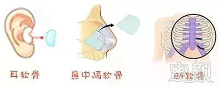 https://img.miyanlife.com/mnt/timg/180627/1213224141-5.jpg