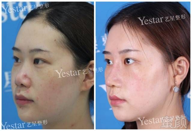 https://img.miyanlife.com/mnt/timg/180627/121322ET-7.jpg