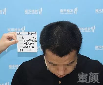 https://img.miyanlife.com/mnt/timg/180627/121S36127-9.jpg