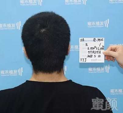 https://img.miyanlife.com/mnt/timg/180627/121S46328-11.jpg
