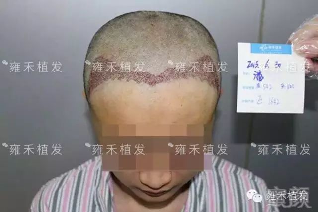 https://img.miyanlife.com/mnt/timg/180627/12202I457-0.jpg