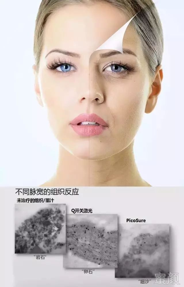 https://img.miyanlife.com/mnt/timg/180627/1223491R7-9.jpg