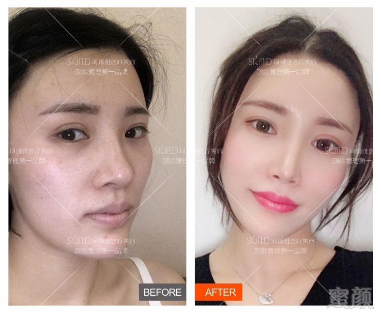 https://img.miyanlife.com/mnt/timg/180627/1233145939-4.jpg