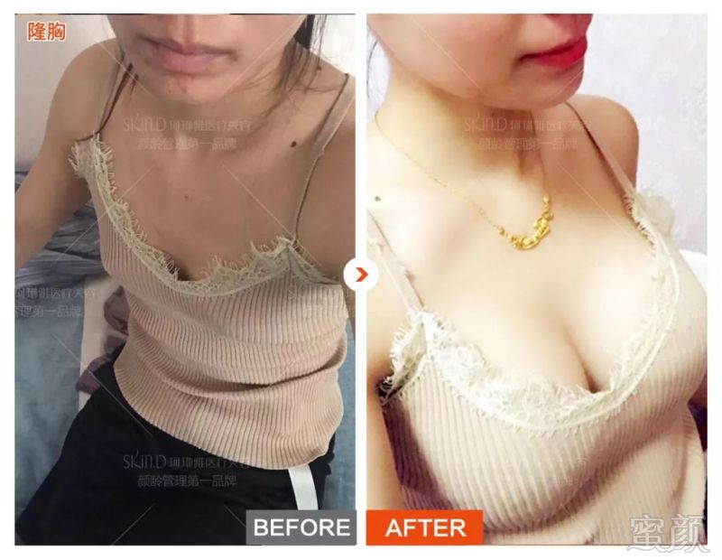 https://img.miyanlife.com/mnt/timg/180627/12331J192-7.jpg
