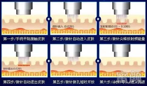 案例图片