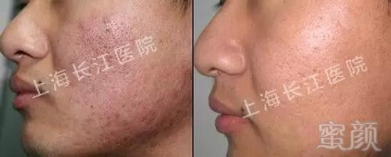 https://img.miyanlife.com/mnt/timg/180627/12442C345-4.jpg