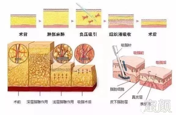 https://img.miyanlife.com/mnt/timg/180628/1041094196-15.jpg