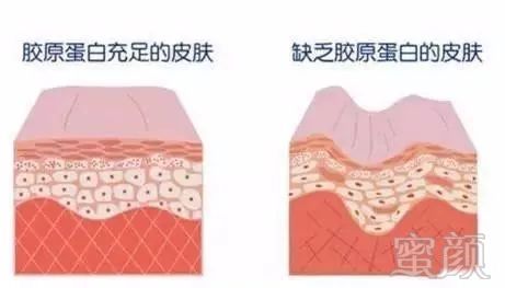 https://img.miyanlife.com/mnt/timg/180628/10410G637-5.jpg