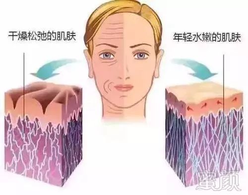 https://img.miyanlife.com/mnt/timg/180628/10410G961-6.jpg