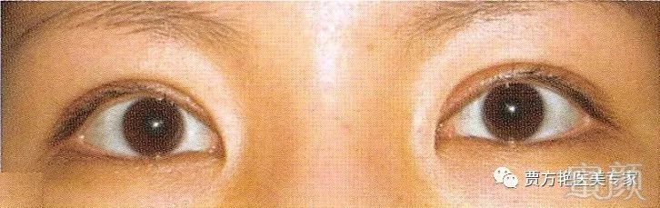 https://img.miyanlife.com/mnt/timg/180628/1103264a0-3.jpg