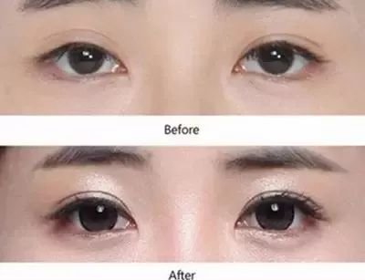 https://img.miyanlife.com/mnt/timg/180628/1105464b0-8.jpg