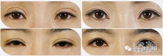 https://img.miyanlife.com/mnt/timg/180628/11054A1R-7.jpg