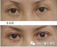 https://img.miyanlife.com/mnt/timg/180628/11054C4a-9.jpg